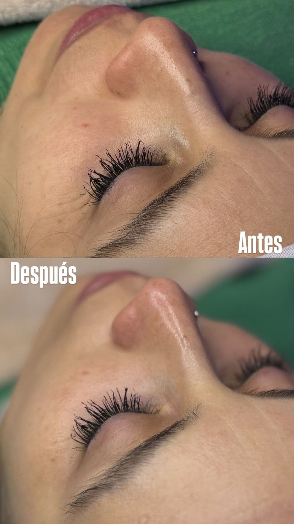 Cejas y pestañas, antes y después