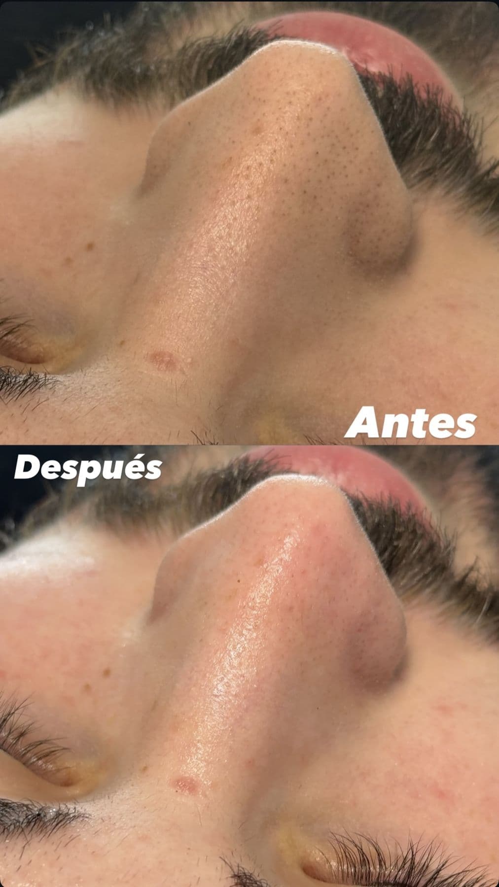 Piel, antes y después